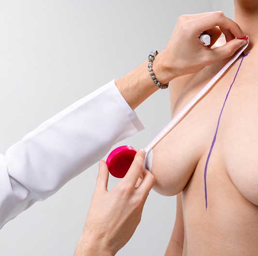 El pezón se sitúa por debajo del surco mamario