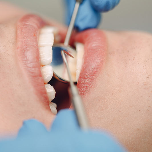 Te cuesta comer determinados alimentos por la ausencia de dientes