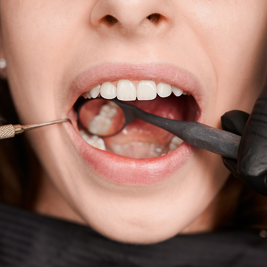 Has perdido una o varias piezas dentales